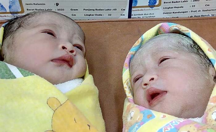 Bayi kembar Gea Nur Latifah dan  Dea Nur Latifah, putri Sekretaris Koran Sindo Biro Jatim. (foto: tom)