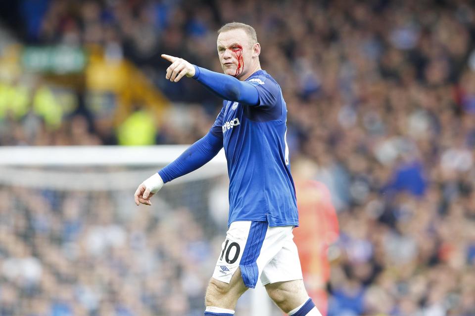 Dengan mata mengucur darah, pemain Everton Wayne Rooney menunjuk wasit yang tak menghentikan pertandingan. 