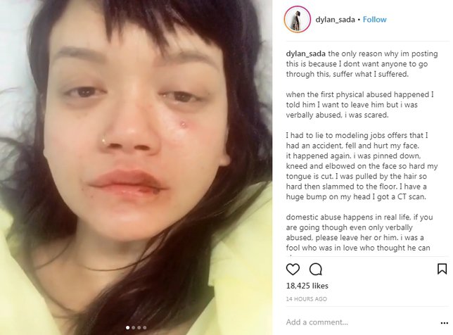Curhatan Dylan Sada di Instagram. (Foto: Instagram)