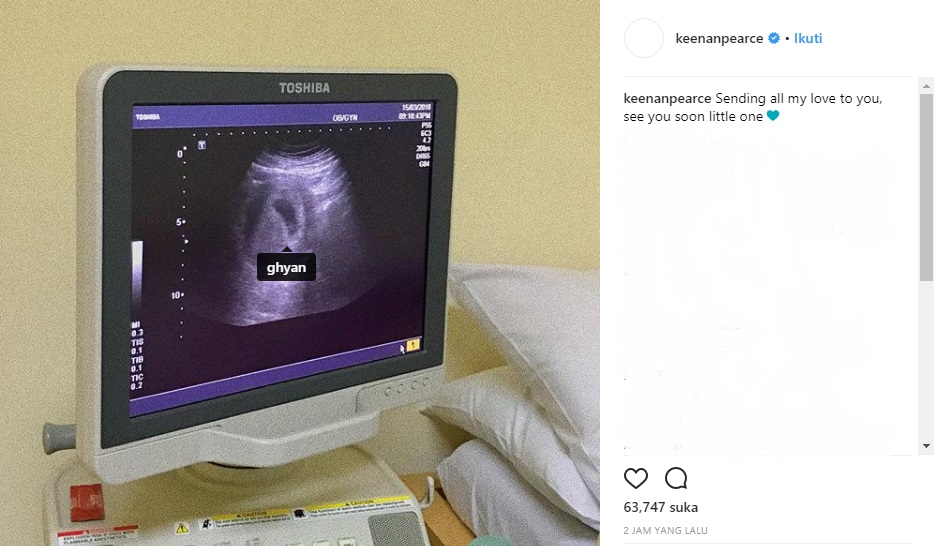 Unggahan Keenan Pearce yang memperlihatkan hasil USG istrinya. (Instagram)