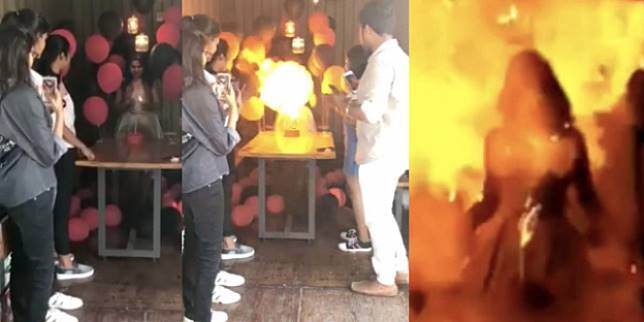 Gadis yang berulang tahun terbakar saat acara tiup lilin.