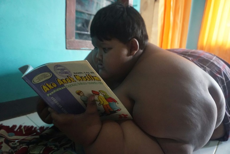 Kondisi Ariya Permana saat berat badannya mencapai 192 kilogram.
