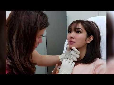 Gisella Anastasia melakukan suntik filler di dagu. foto: instagram/rere_clinic.