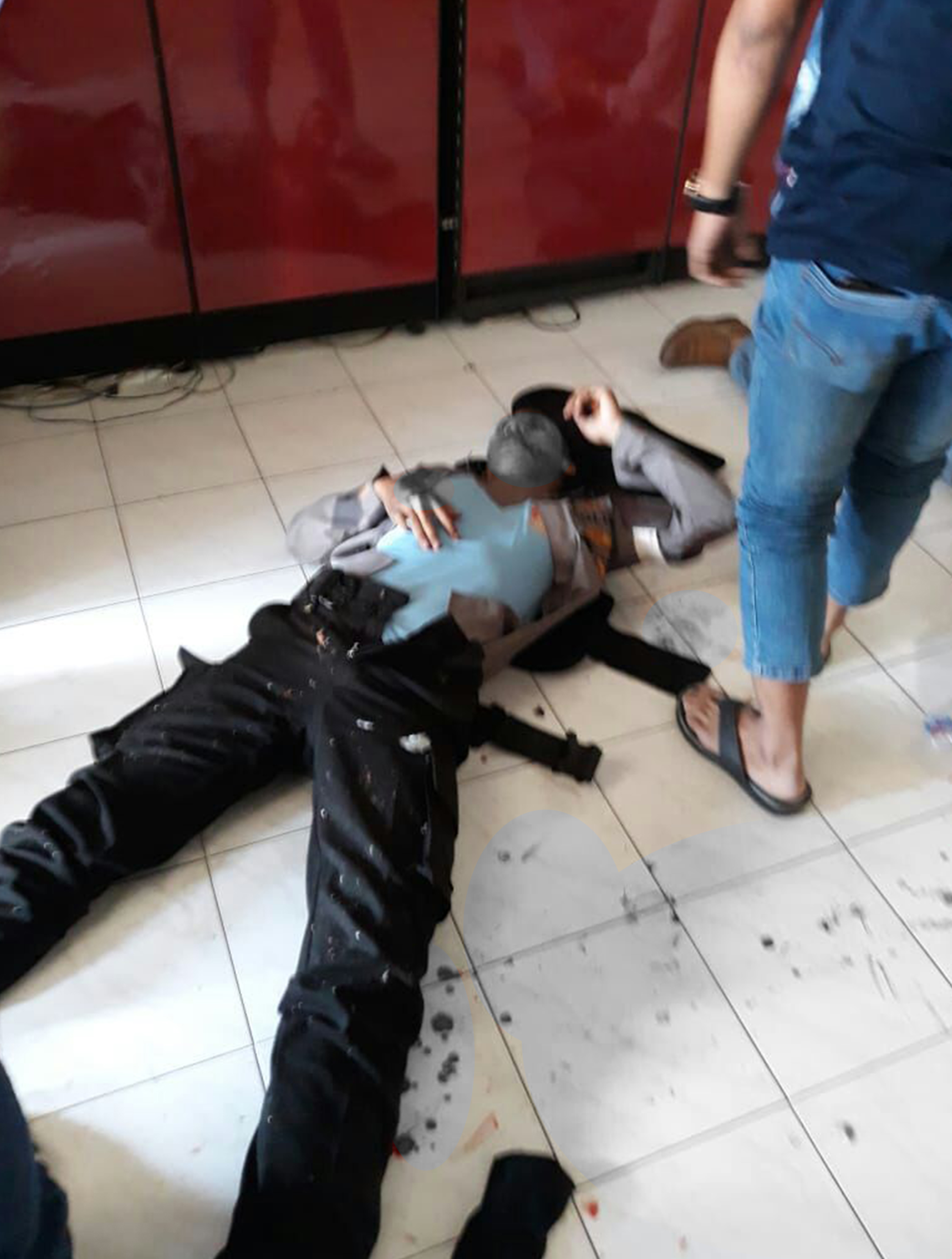 Tampak salah satu korban dari aparat kepolisian