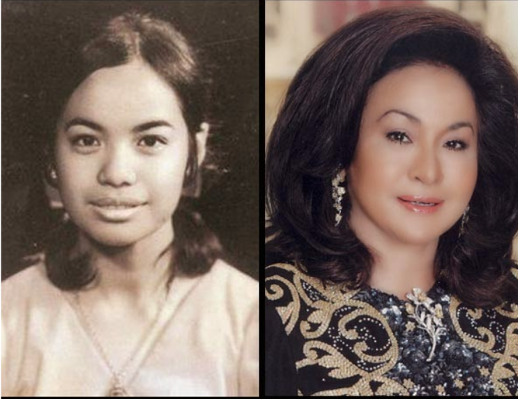 Wajah Rosmah Mansor remaja (kiri), dan setelah operasi plastik.