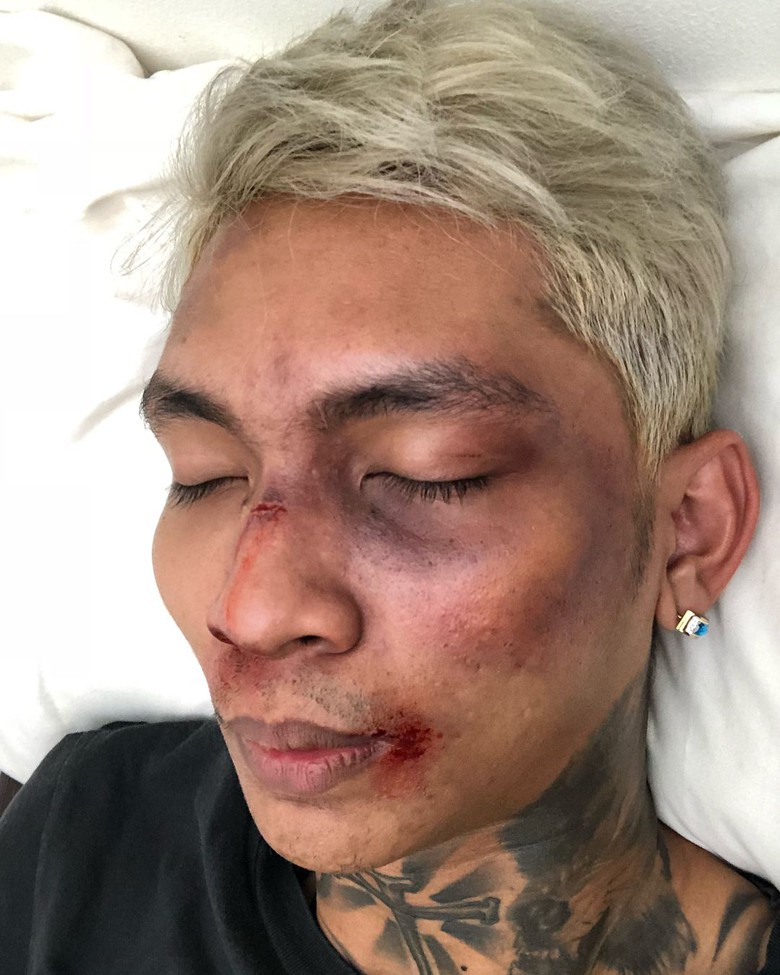 Wajah Young Lex yang babak belum hoax, ternyata hasil make up effect. Foto: IG/young_lex18.