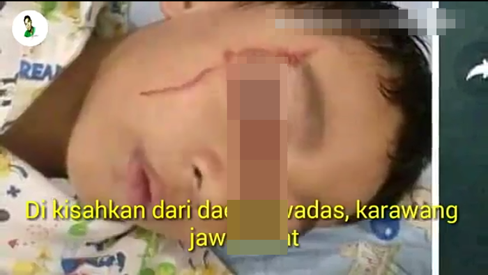 Mata bocah bernama Fajar mengeluarkan air mata bercampur darah. Foto: capture youtube/kangzee.