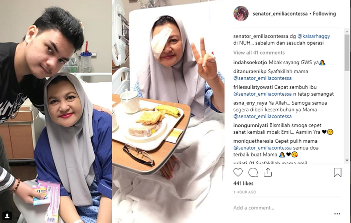 Emilia Contessa usai operasi mata kanan di rumah sakit yang sama dengan cucunya, Shakira Aurum di Singapura.