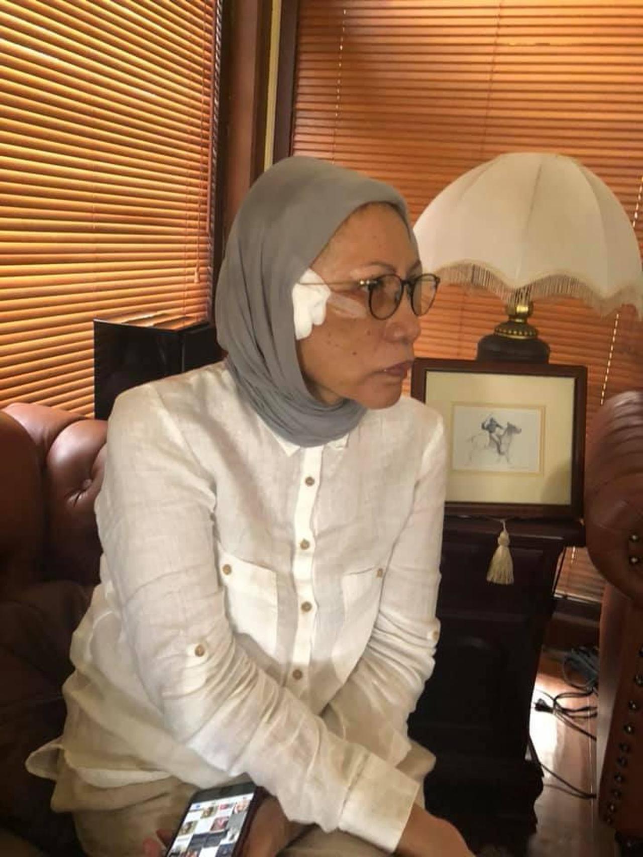 Akting Ratna Sarumpaet sebagai korban pengeroyokan.