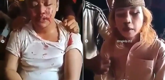 Dua korban yang mengaku sebagai Habib Bahar babak belur.