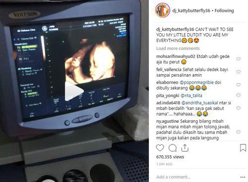 Ia memperlihatkan video hasil pemeriksaan kehamilannya melalui USG 4 dimensi (4D) di akun Instagram, @dj_kattybutterfly36.