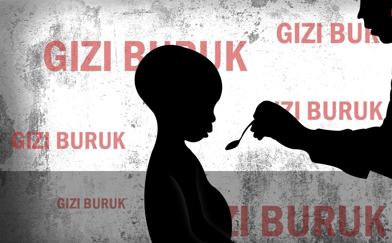 Ilustrasi anak menderita gizi buruk. (Foto: aktual.com)