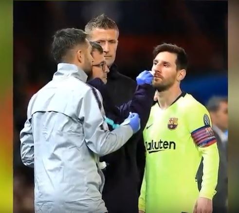 Dalam situasi berebut bola, wajah Lionel Messi dihantam dengan keras oleh Chris Smalling.