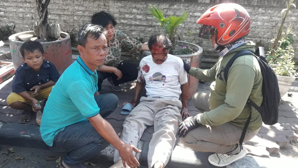 Korban mengalami luka di bagian wajah.