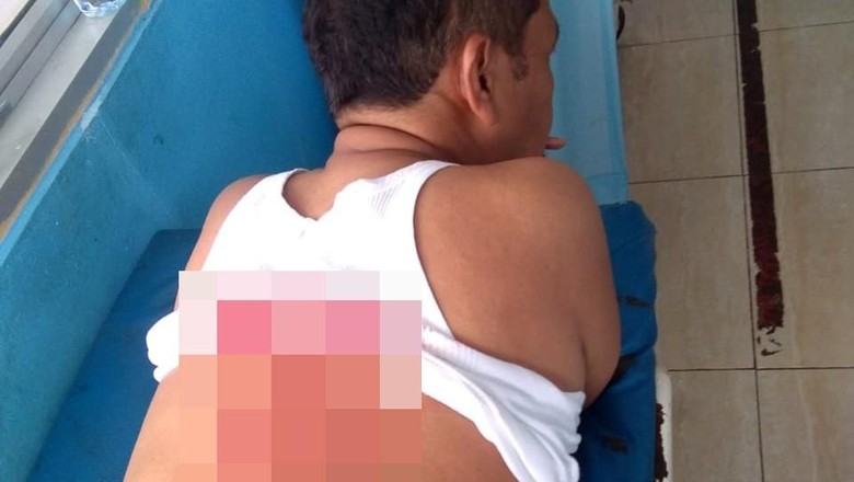 Kapolsek Menes, Kompol Dariyanto terluka di bagian punggung. (Foto: Istimewa)