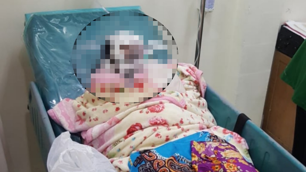 Putri Narulita korban kekejaman suami yang terbaring lemah di rumah sakit. (Foto: Istimewa)