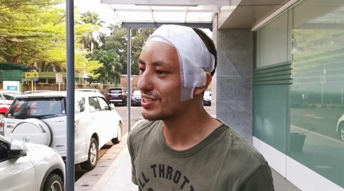 Kondisi kepala aktor Dylan Carr masih diperban, usai dua kali operasi tempurung otak. (Foto: Istimewa)