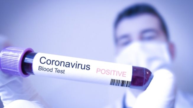 Virus Corona. (Foto: Istimewa)