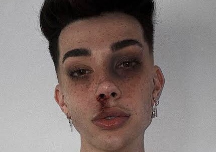 James Charles dalam Mugshoot Challenge. (Foto Eonline.com)