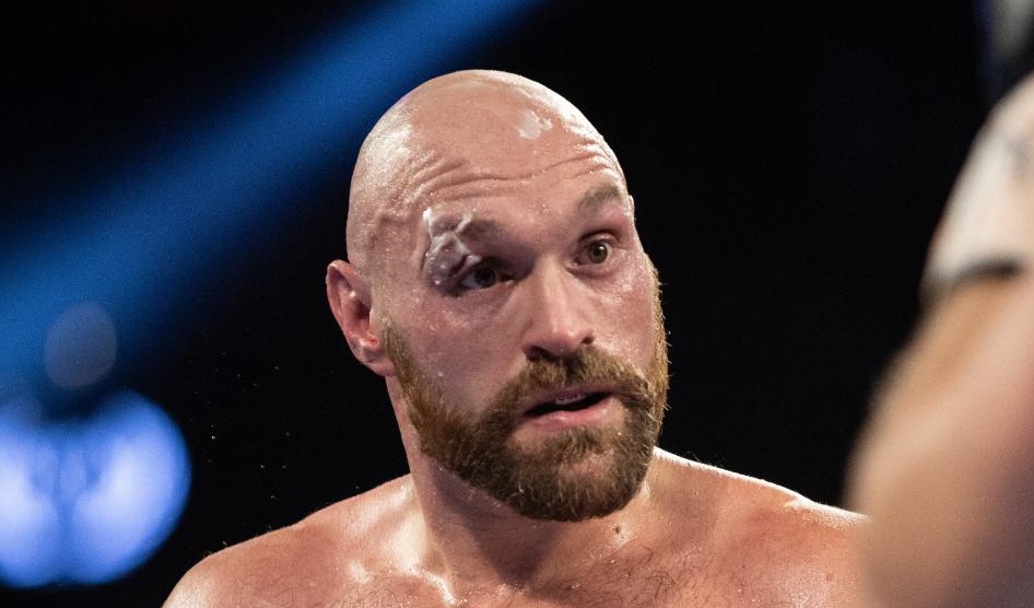 Tyson Fury. (Foto: Twitter/@Tyson_Fury)