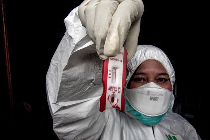 Alat deteksi dini (rapid test) virus corona (Foto: Antara)