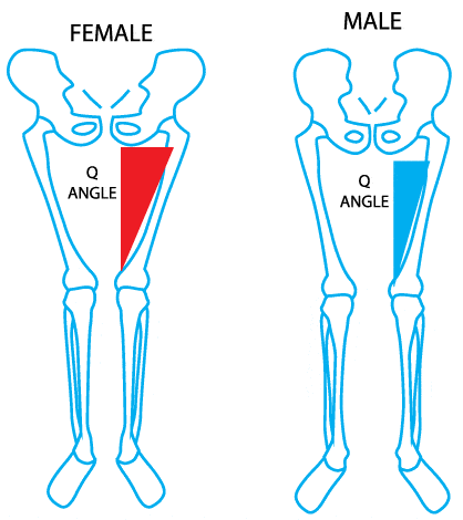 Q Angle antara laki-laki dan perempuan. 