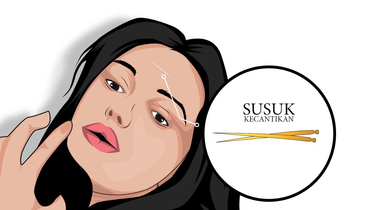 Ilustrasi susuk. (Ilustrasi: Fa Vidhi/Ngopibareng.id)