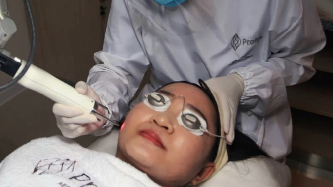 Treatment Pico Collagent Laser untuk penghilang bopeng. (Foto: Istimewa)