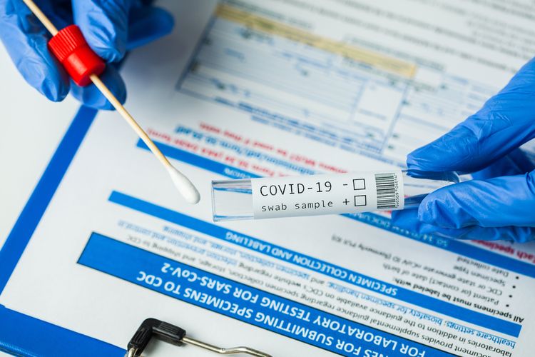 Ilustrasi rapid test antigen. (Ilustrasi: Istimewa)