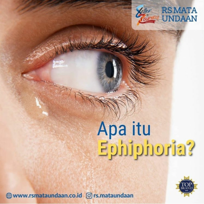 Ilustrasi ephiphoria. (Foto: dok RSMU)