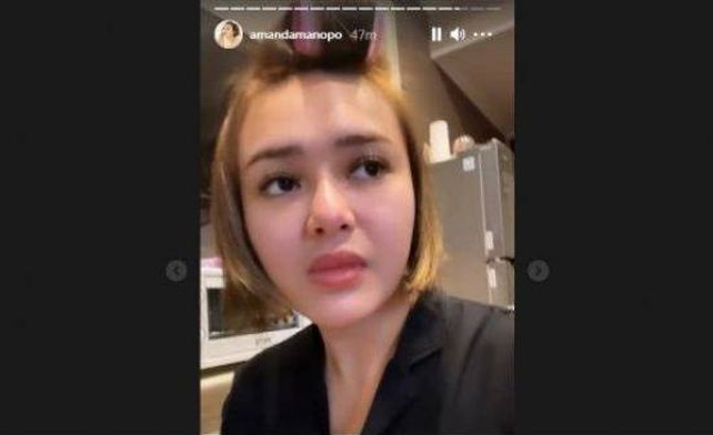 Bibir dan hidung Amanda Manopo tampak bengkak usai melakukan suntik vitamin C. Netizen menduga dia melakukan filler. (Foto: Instagram Amanda Manopo)