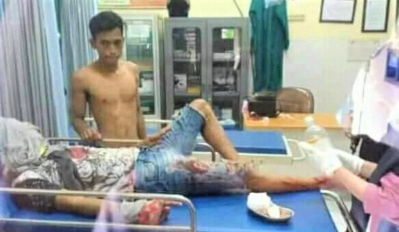 Eko Wahyudi dirawat di RSUD dr. Mohamad Saleh, Kota Probolinggo karena luka bacok. (Foto: Istimewa)