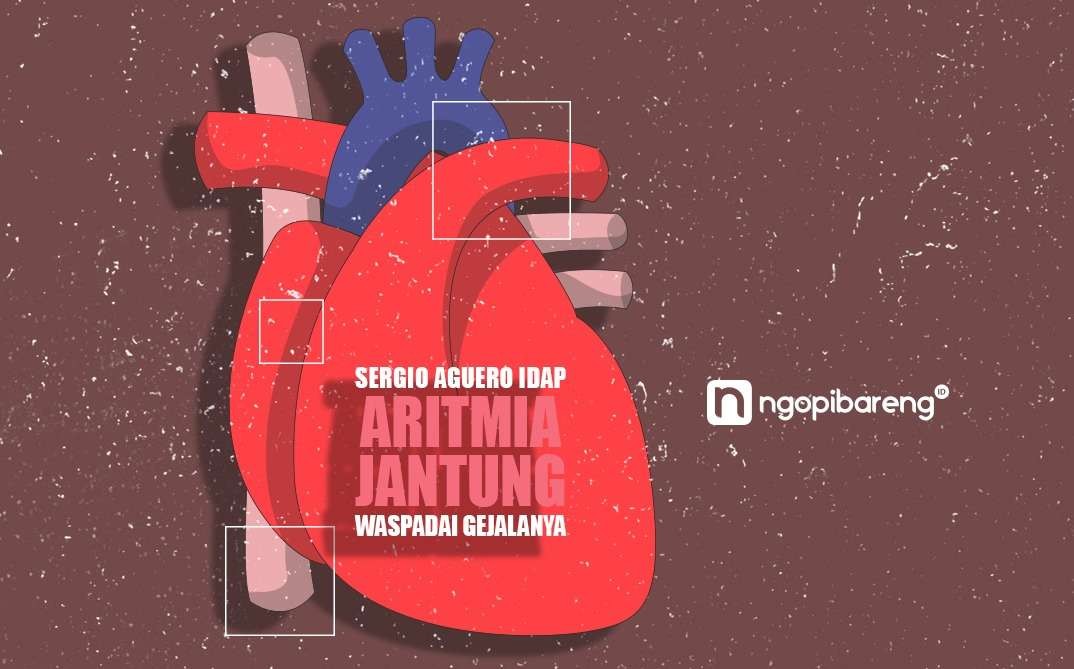 Ilustrasi aritmia jantung (cardiac arrythmia) atau gangguan irama jantung. (Grafis: Fa Vidhi/Ngopibareng.id)