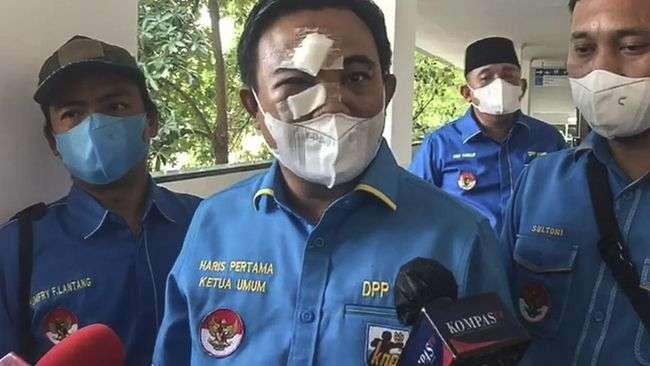 Ketum KNPI hadiri sidang Ferdinand Hutahaean dengan wajah babak belur