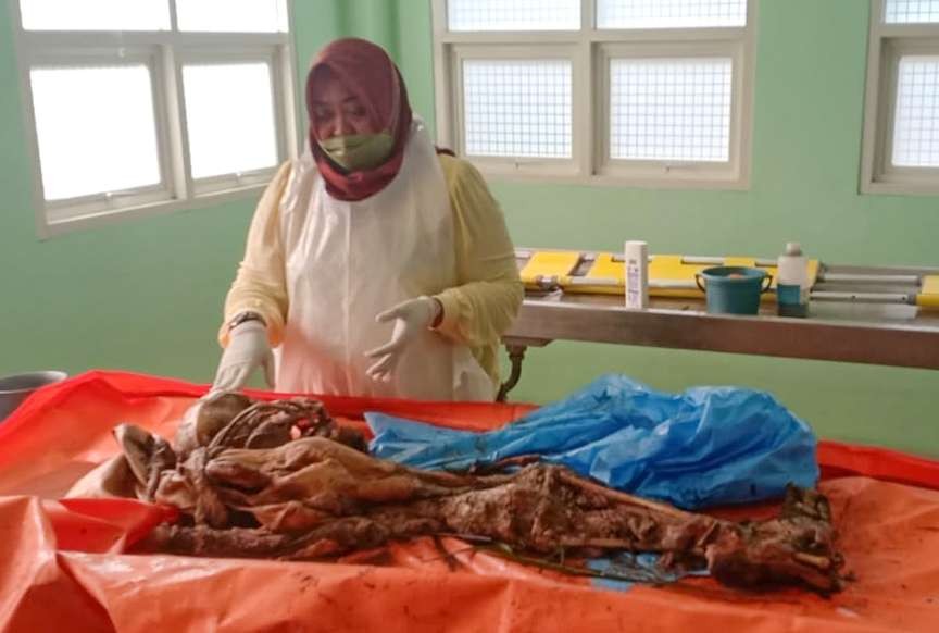 Dokter Forensik RSUD Sidoarjo menunjukkan kerangka manusia yang ditemukan di Gedangan. (Foto: Aini Arifin/Ngopibareng.id)