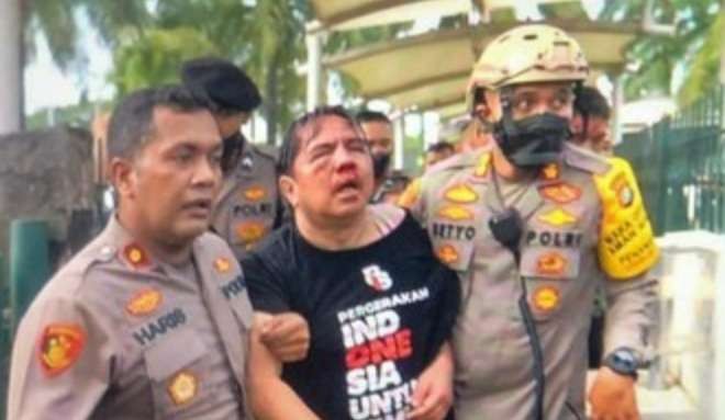 Penggiat media sosial Ade Armando korban pengeroyokan saat dievakuasi polisi. (Foto: Istimewa)