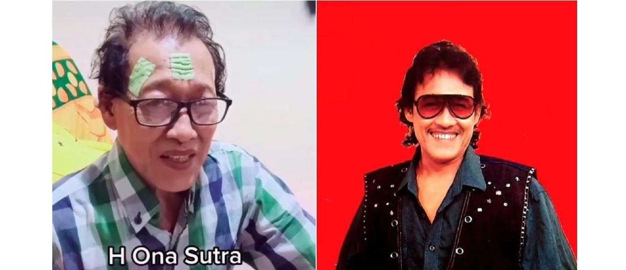 Pedangdut Ona Sutra punya ciri khas kaca mata hitam dan rambut ikalnya. (Foto: Istimewa)