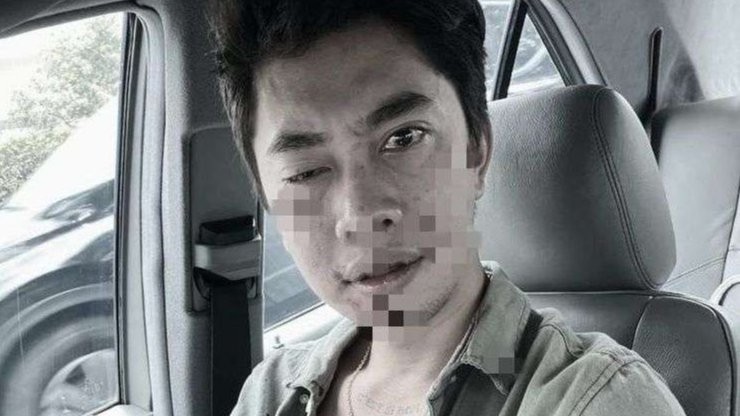 Justin Frederick, anak politisi PDIP, Indah Kurnia, babak belur dipukuli pengendara mobil berpelat RFH. (Foto: Instagram)