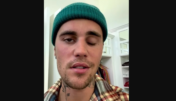 Justin Bieber umumkan bahwa dirinya mengalami kelumpuhan wajah, yakni Ramsay Hunt Syndrome atau sindrom Ramsay Hunt. (Foto: Instagram @justinbieber)