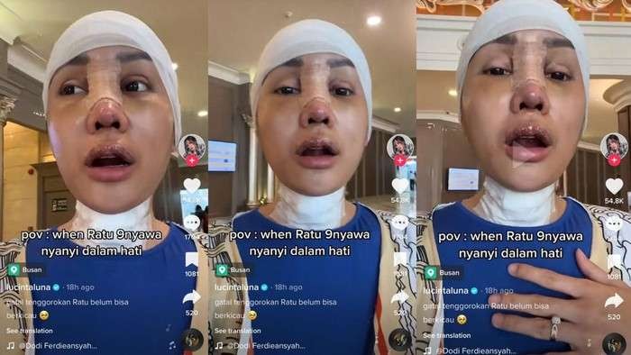 Penampakan Lucinta Luna usai menjalani serangkaian operasi, mulai potong jakun, tulang ekor hingga ganti kulit. (Foto: Instagram Lucinta Luna)