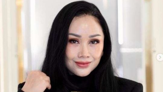 Wajah baru Titi DJ usai operasi anti aging di Korea Selatan. (Foto: Instagram @ti2dj)