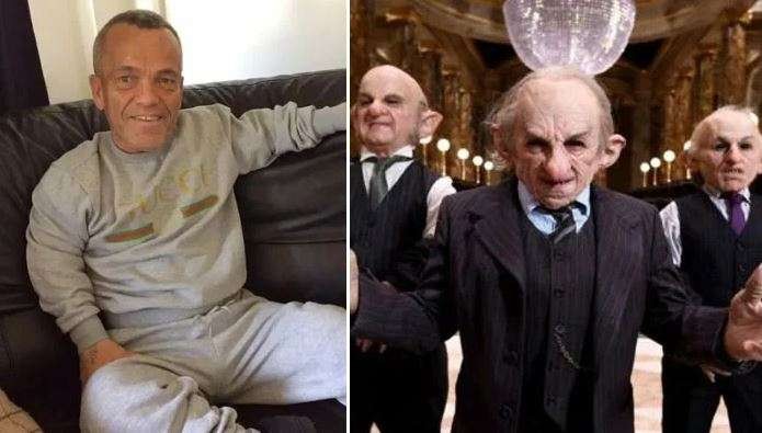 Paul Grant, bintang film Harry Potter dan Star Wars ini meninggal akibat mati otak. (Foto: Geo.TV)