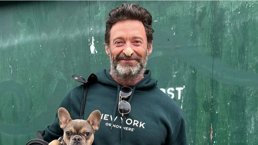 Aktor Hugh Jackman penyitas kanker kulit. (Foto: Instagram @thehughjackman)