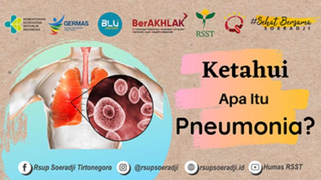 Kementerian Kesehatan RI mengimbau masyarakat agar tidak panik menyusul penyebaran undefined pneumonia. (Dok. yankes.kemenkes ri)