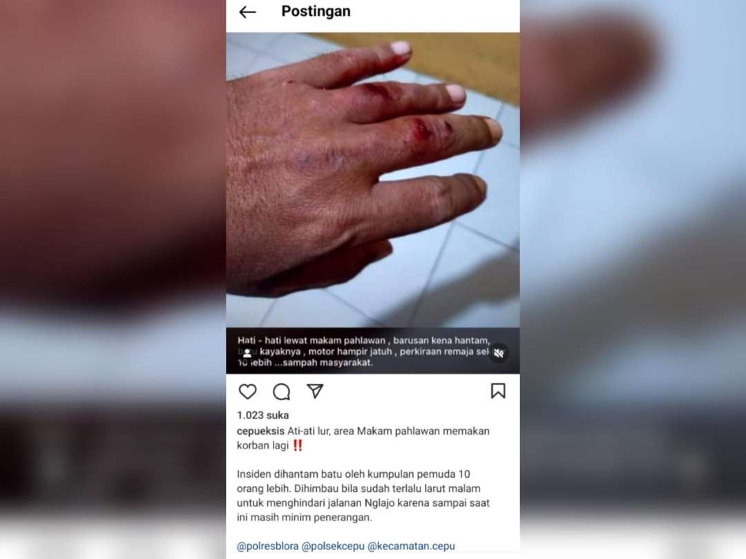 Postingan Instagram @cepueksis yang menjadi perbincangan warganet. (Foto: Tangkapan Layar)