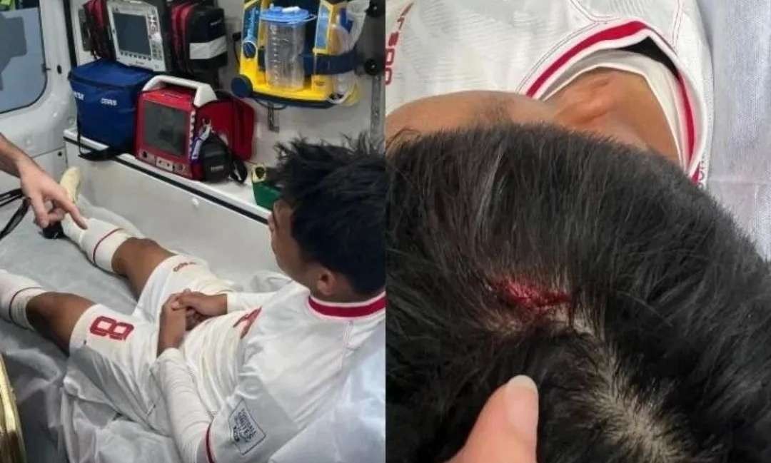 Kepala kapten Timnas Indonesia, Witan Sulaiman bocor usai tabrakan dengan Camara, pemain Guinea dalam babak pertama playoff Olimpiade Paris 2024, Kamis 9 Mei malam waktu Indonesia. (Foto: Instagram @rismahanisulaiman_)